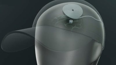 Ce minuscule implant cérébral pourrait traiter la dépression à la maison