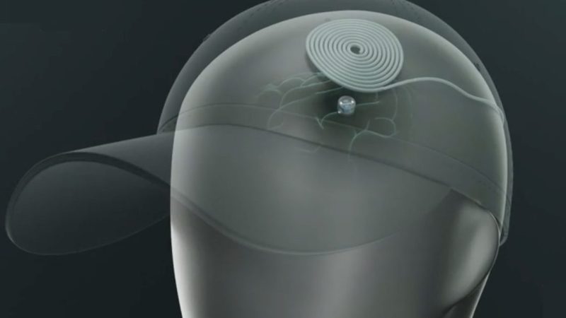 Ce minuscule implant cérébral pourrait traiter la dépression à la maison