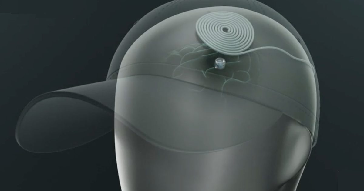 Ce minuscule implant cérébral pourrait traiter la dépression à la maison